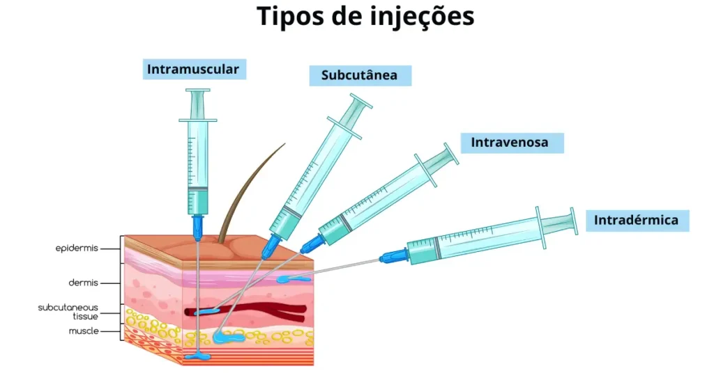 tipos de injeções